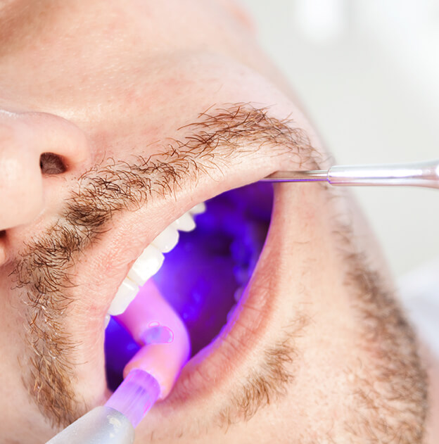 closeup of a man having his mouth examined for oral cancer