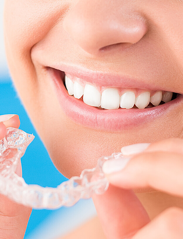 closeup of person inserting their clear aligners onto their teeth