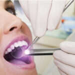 woman getting an oral cancer screening at the dentist