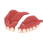 broken denture, denture repair, Mauka Family Dental, Dr. Ji Kim, Mililani HI dentist, dental emergency